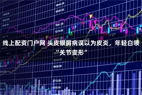 线上配资门户网 头皮银屑病误以为皮炎，年轻白领“关节变形”